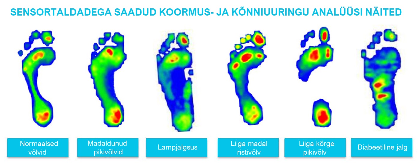 Suurim viga koos abaluu all valu-ga